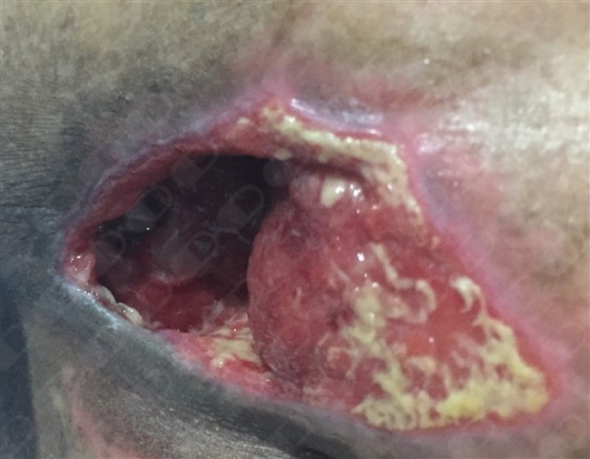 Angel Manuel Piña Jaén-4