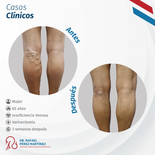 Rafael Pérez Martínez-5