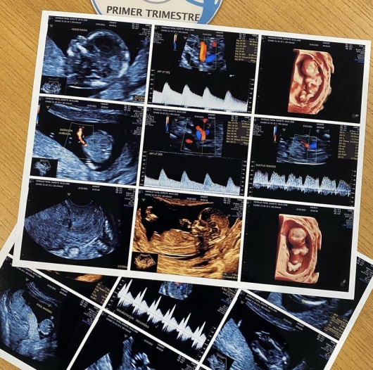 Alejandro Gaspar Vera-10