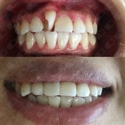 Analí García García-7