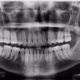 Centro Radiologico Craneodental