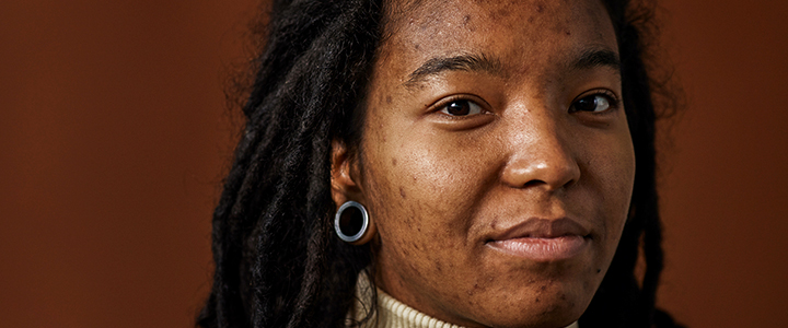 Clareadores de pele: descubra os melhores ativos e produtos | Bioage