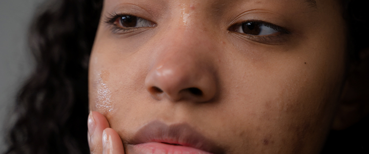 Clareadores de pele: descubra os melhores ativos e produtos | Bioage