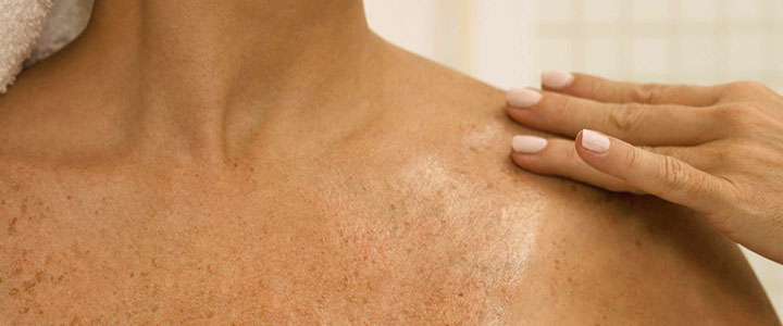Pele sensível ou reativa: cuidados para toda esteticista | Bioage