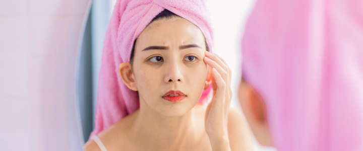 Produtos e ativos para olheiras: quais recomendar? | Bioage