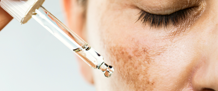 Peeling Ácido Mandélico: esfoliante químico para o inverno | Bioage