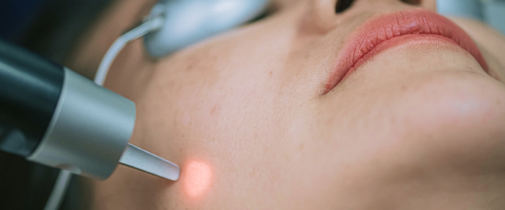 Ácido kójico: o que é, para que serve e quando aplicar | Bioage