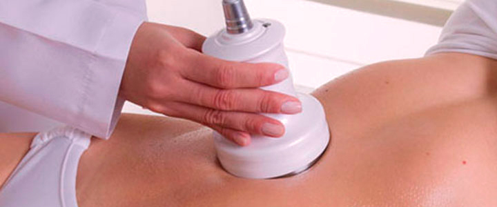 Guia completo de tratamentos estéticos para o verão | Bioage