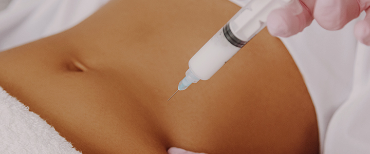 Guia completo de tratamentos estéticos para o verão | Bioage