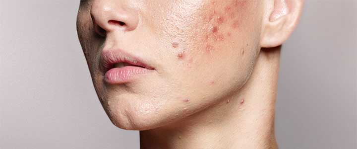 Tudo sobre Bioage Vitamina C: o poder do nosso antioxidante | Bioage