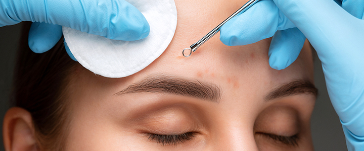 Tudo sobre o emoliente para cravos Bio-Clean System | Bioage