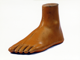 Jaipur Foot and Below Knee prosthesis