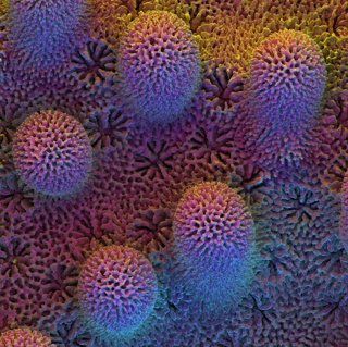 Electron Micrographs