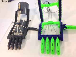 Prosthetic Hand, Robohand