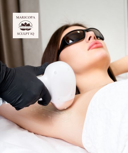 Laser Treatments - Maricopa SculptIQ