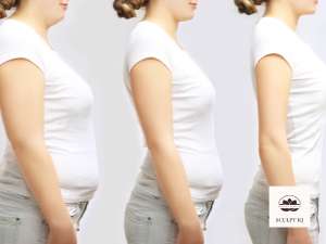Weight Loss Programs & Body Contouring