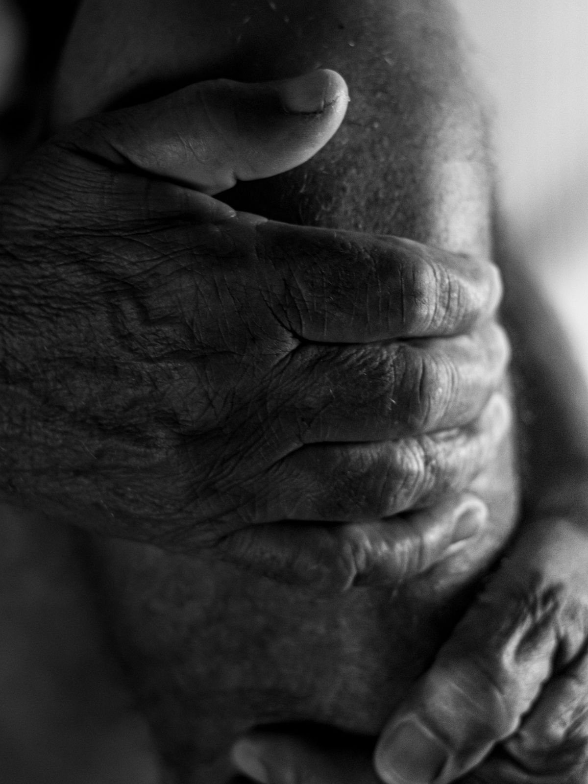 Arthritis Management