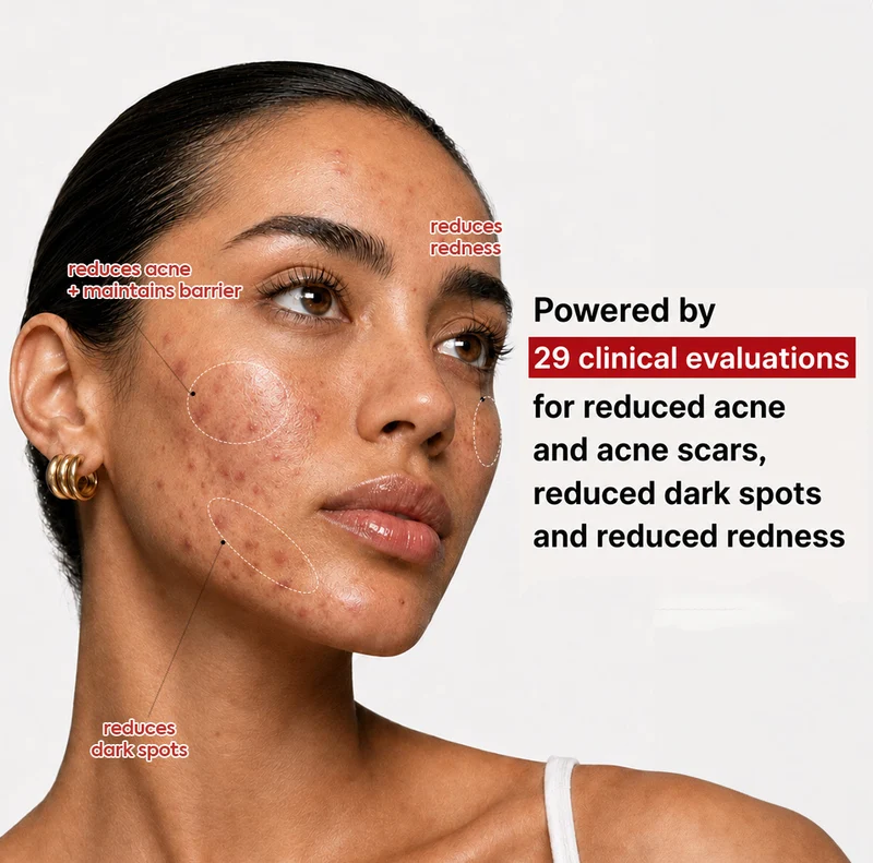 Azatran Dual Power Boosting Capsule Cream - Heartleaf & 99% TXA — image 4