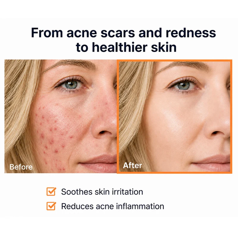 Azatran Dual Power Boosting Capsule Cream - Heartleaf & 99% TXA — image 5