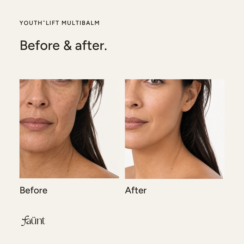 5% Volufiline + PDRN Collagen NAD Youth-Lift Multibalm — image 8