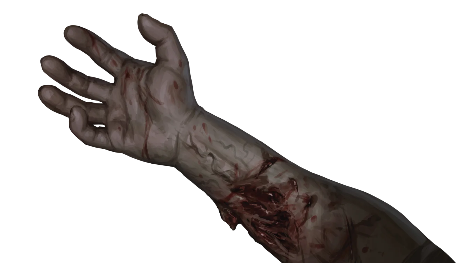 bitten-arm.webp
