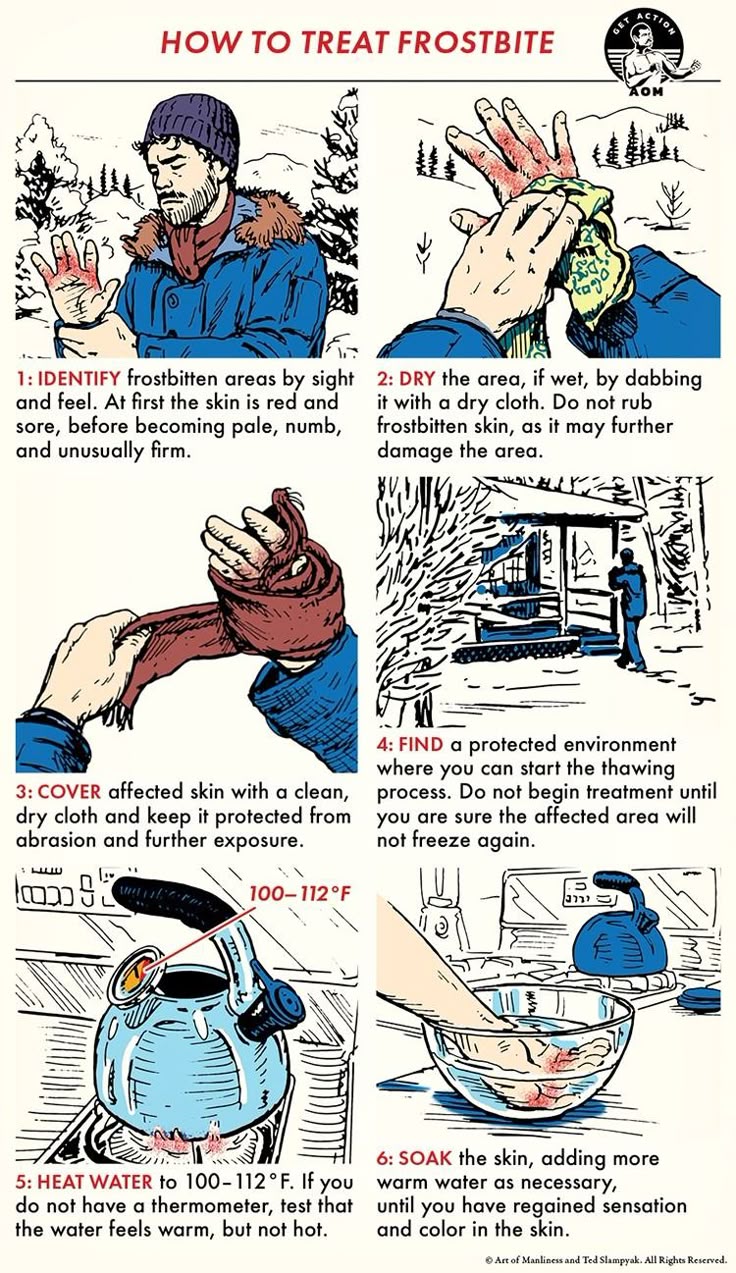 howto frostbite
