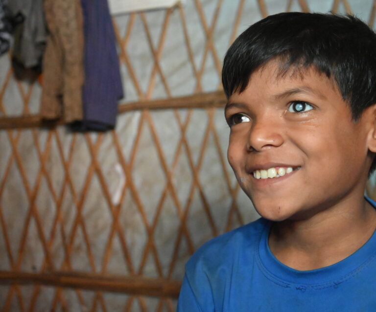 Anas Child Cataract Coxs Bazar 22 1