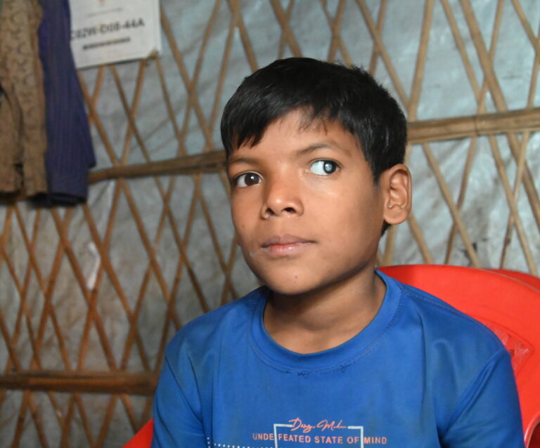 Anas Child Cataract Coxs Bazar 33 1