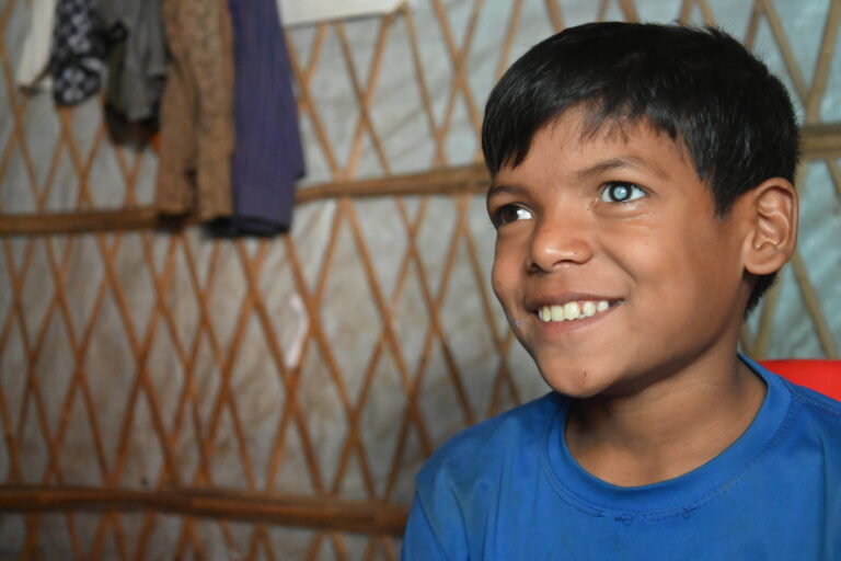 Anas Child Cataract Coxs Bazar 22 1