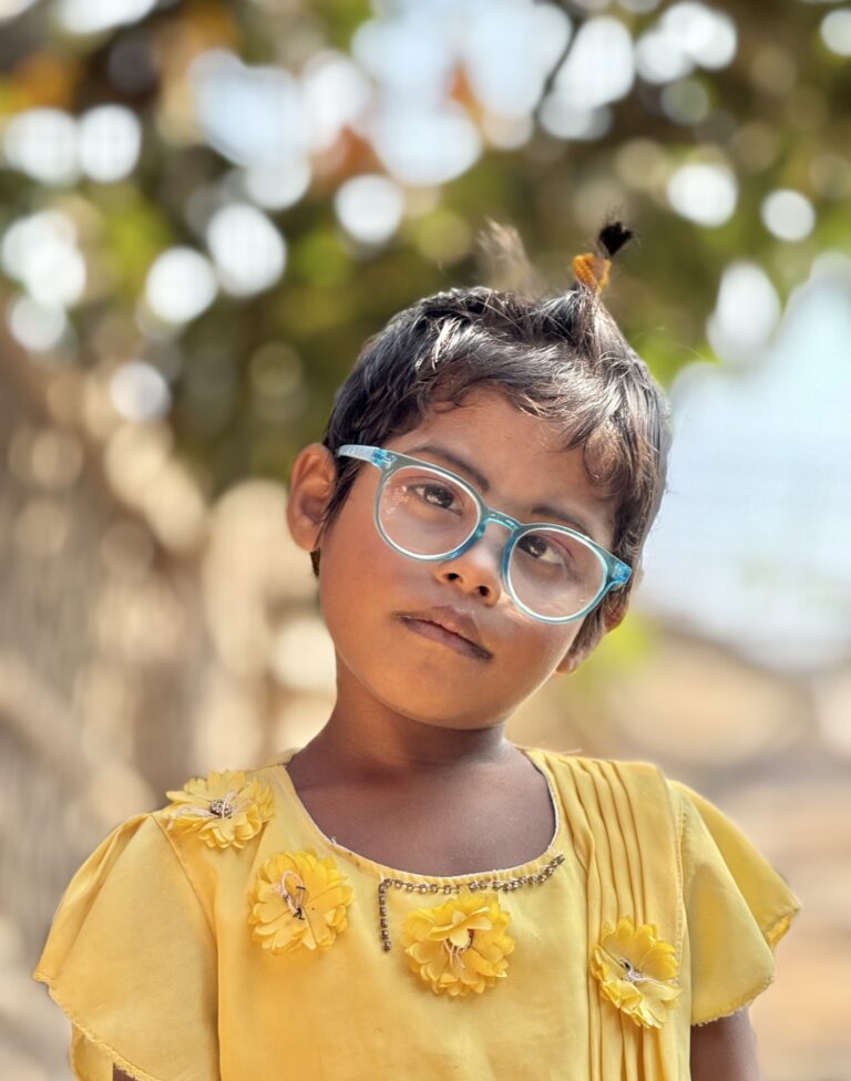 Ridwana Child Cataract Follow up Coxs Bazar 12