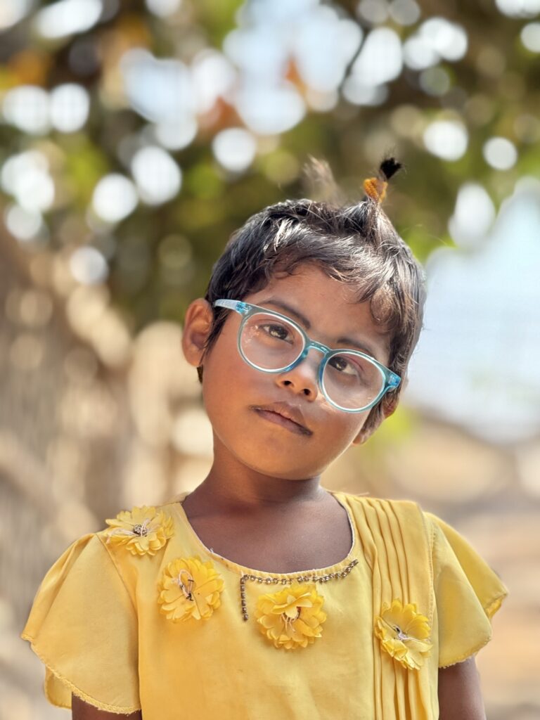 Ridwana Child Cataract Follow up Coxs Bazar 12