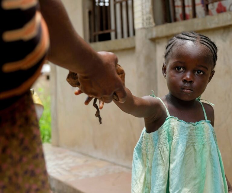 Praises Ghana 2025 Pre Surgery 1