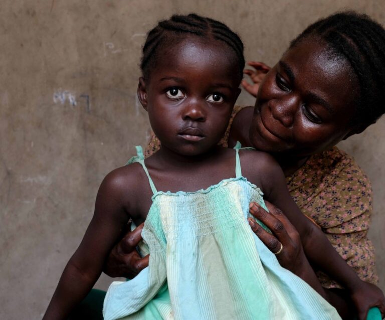 Praises Ghana 2025 Pre Surgery 2
