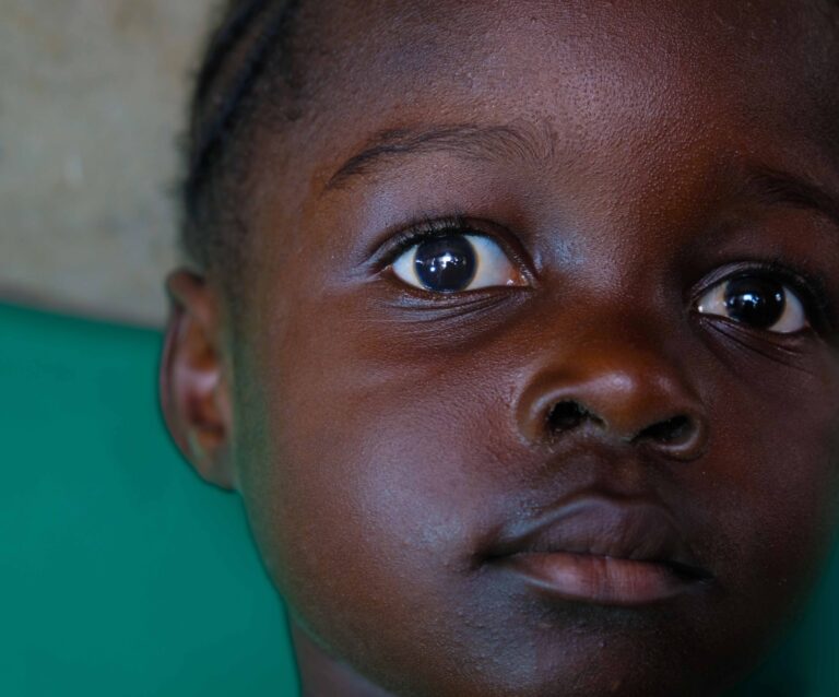 Praises Ghana 2025 Pre Surgery 3