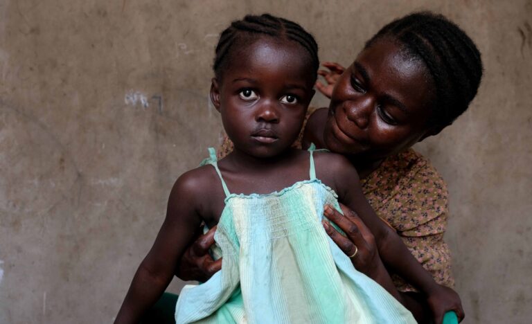 Praises Ghana 2025 Pre Surgery 2