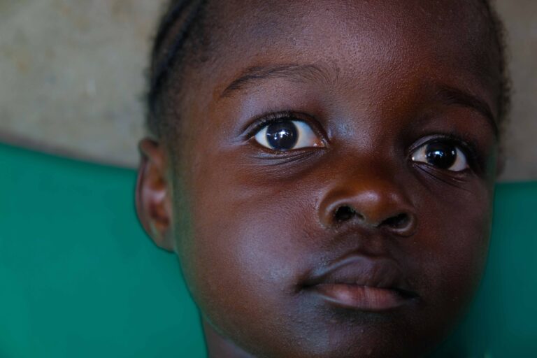 Praises Ghana 2025 Pre Surgery 3