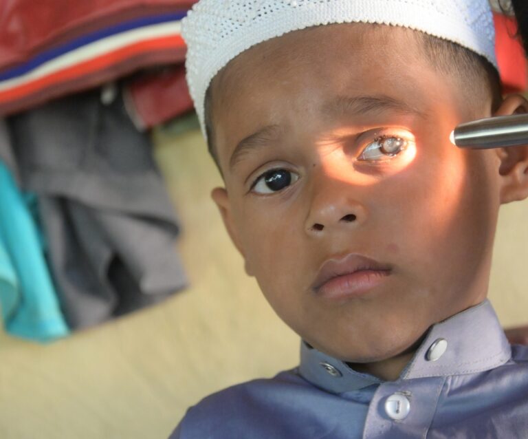 Morium Arafat Child Cataract Coxs Bazar 24
