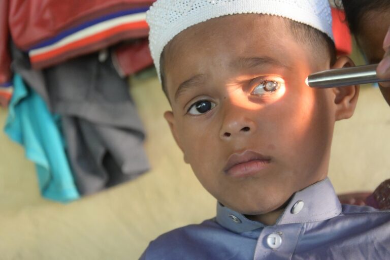 Morium Arafat Child Cataract Coxs Bazar 24