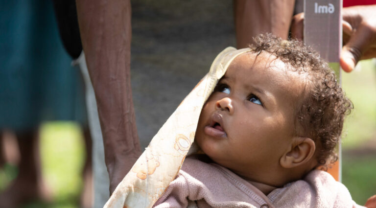 Ethiopia 2019 c Z Abubeker MDA distribution An infant is measured with a dose pole