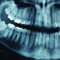 Psg portfolio Dental Intelligence2 background