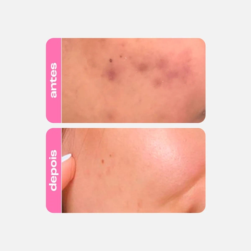 Niacinamide Sérum Fortalecedor Antioleosidade - foto 2
