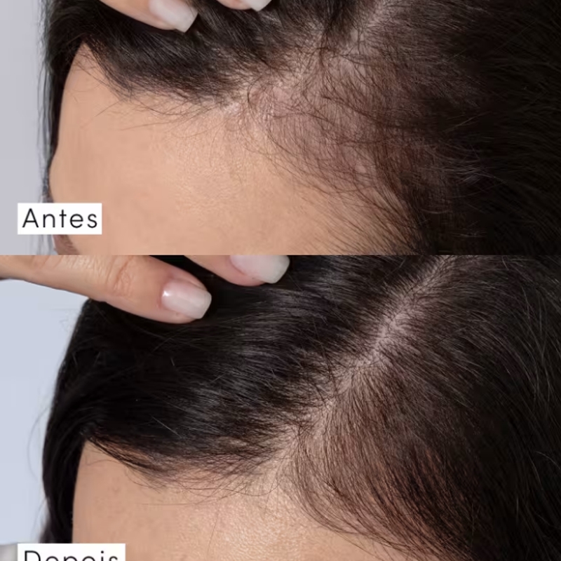 Condicionador Siàge Dermo Hair Resistência Antiqueda 280Ml - foto 2