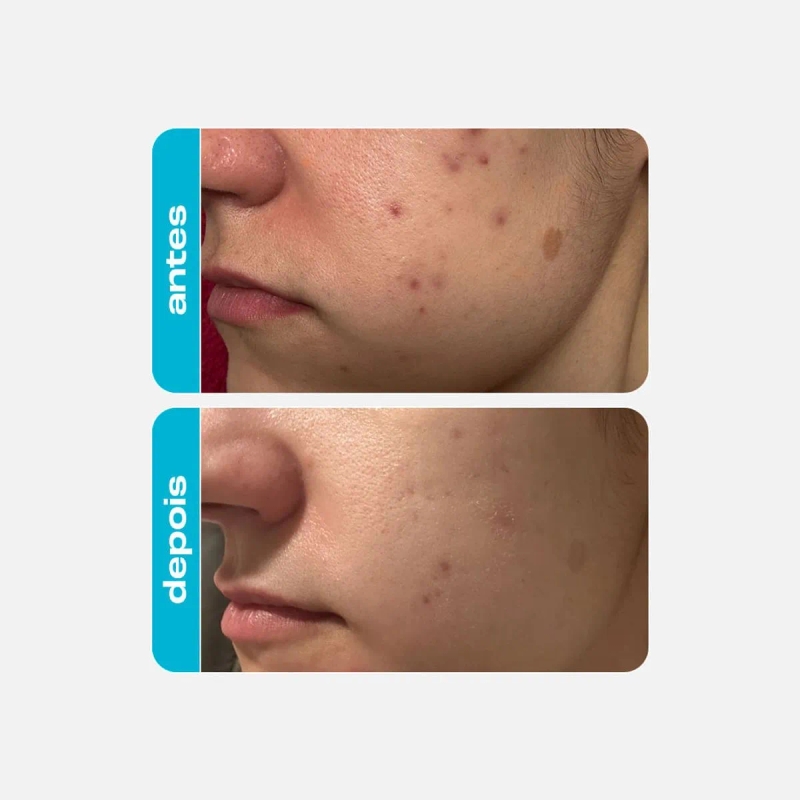 Ácido Glicólico Creme Renovador - foto 2