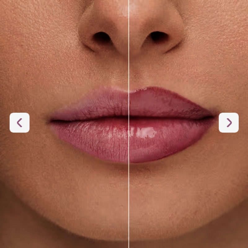 Gloss Labial Micro Injection Eudora Make Pink Extreme 5,2ml - foto 3
