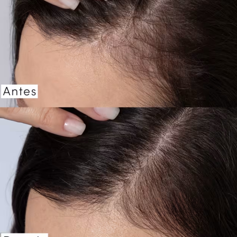 Máscara Capilar Siàge Dermo Hair Resistência Antiqueda 250g - foto 2