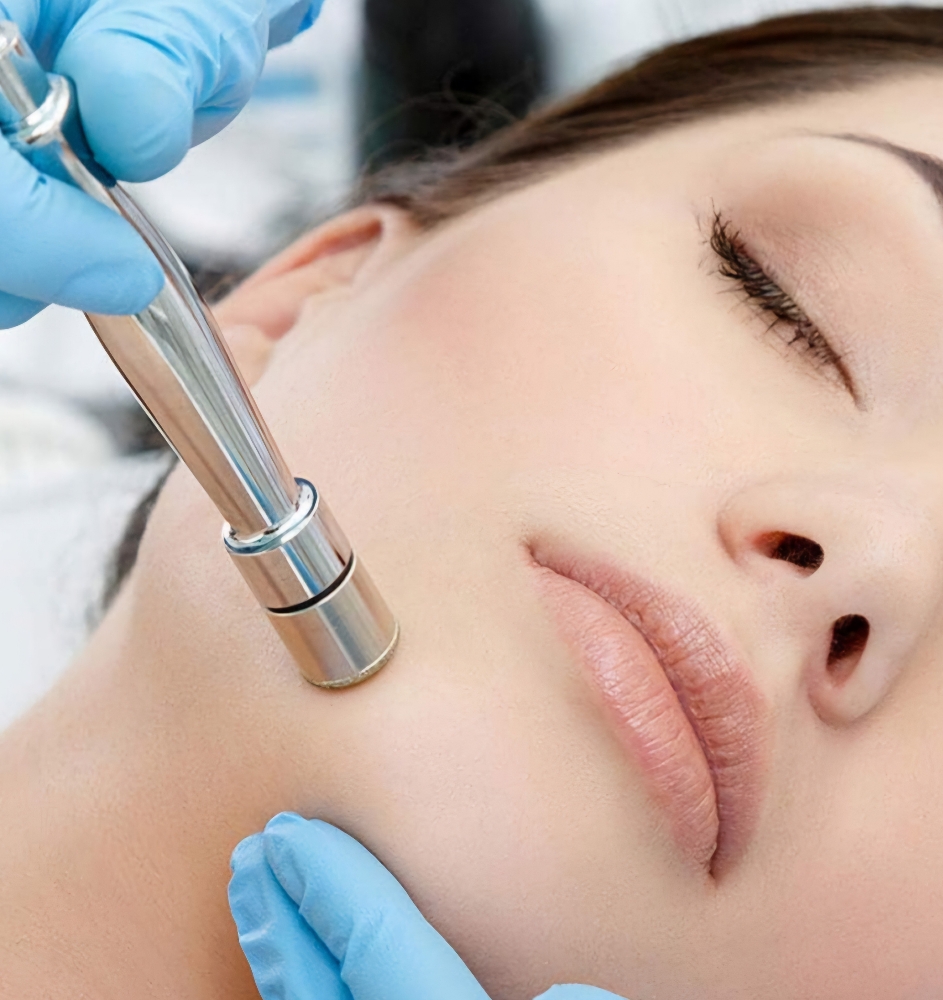 Diamond Dermabrasion Add On