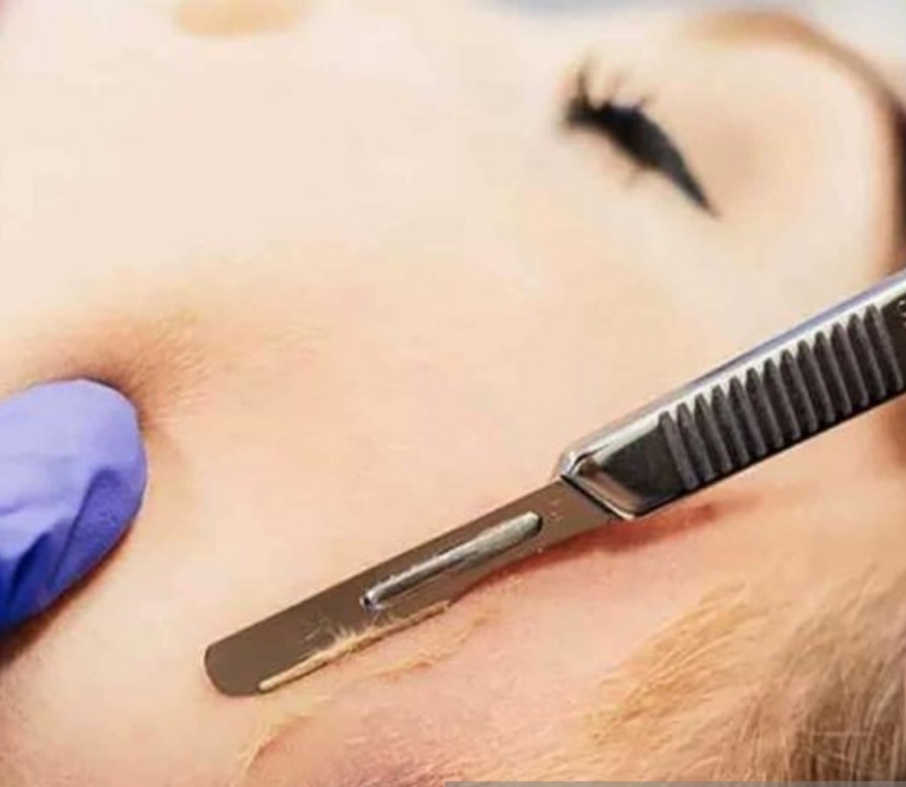 Dermaplane Add On