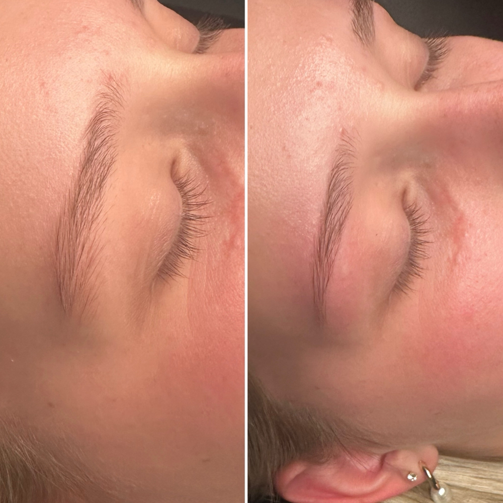 Brow Shaping