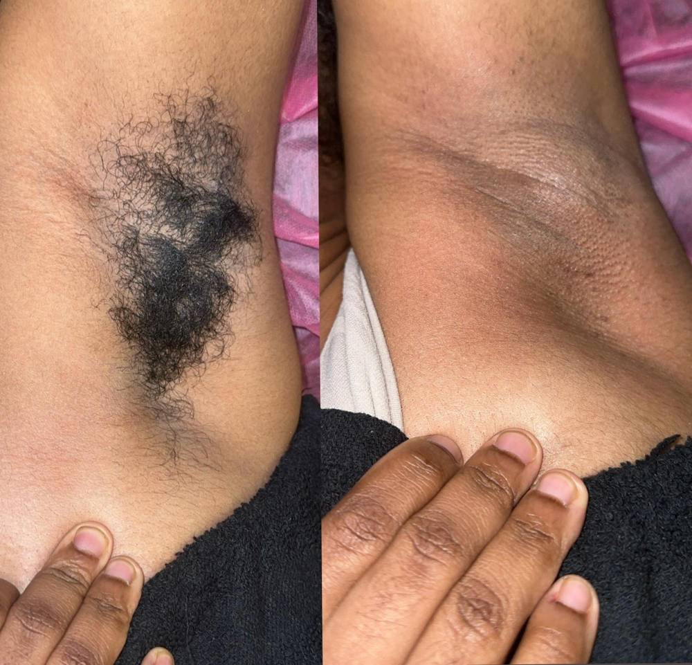 Underarm Wax