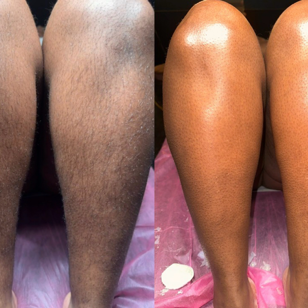 Full Leg Wax